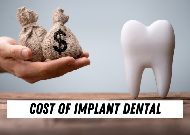 cost of implant dental