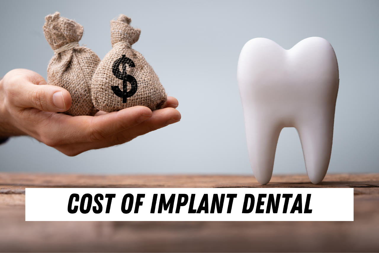 cost of implant dental