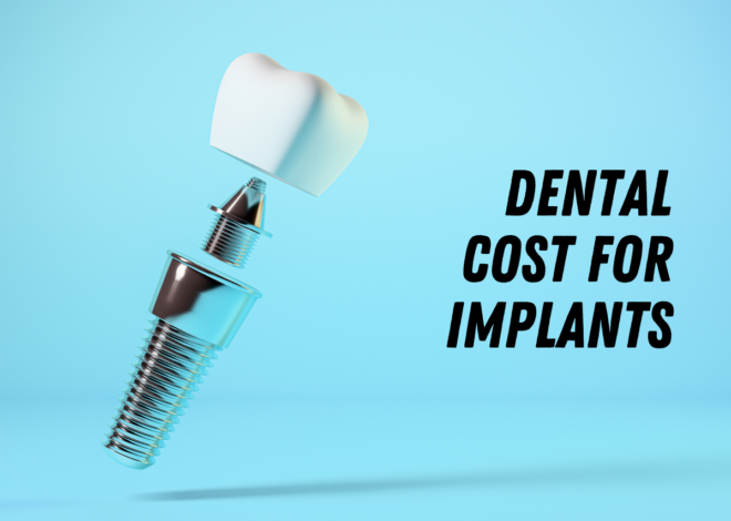 dental cost for implants