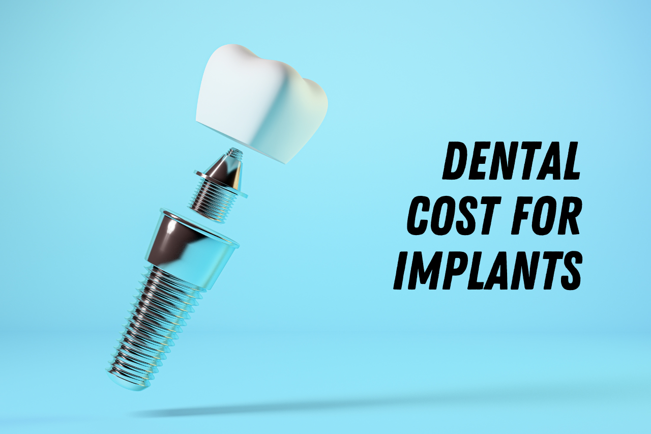 dental cost for implants